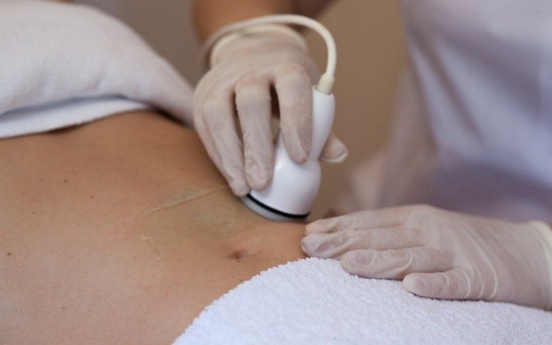 Factor Estetic MM mezokokteli